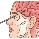 The Anti-Frontal Lobe Association