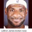 leaking fortnite skins
