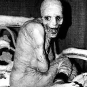 Mental Patients Of 2b2t