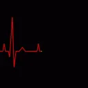 Cardiac Arrest