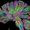 Neurodiversity Social Support Group
