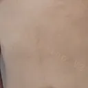 q-p.g