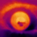 the eye