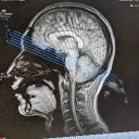 cognitive enhancement