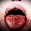 /disease