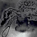 Lobotomia