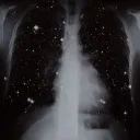 {+ Cimetière Loss +} 🛰