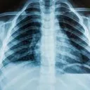 RMIT Medical Radiations 2025