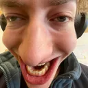 Allergischer Server