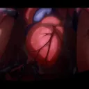 Anicardiac