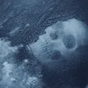 frostbite