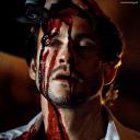୧ ‧₊˚🥩🦴HANNIBAL ࣭ ⭑ZINKLES๋ ࣭ ⭑