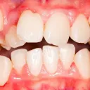 the dentist's office