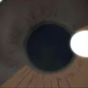 Male Eye/Endo