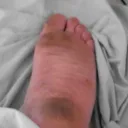 Mum feet