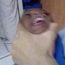 choke