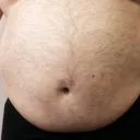 Fatties Unlimited