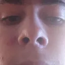 Josh's Nose