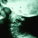 Temporo Mandibular Joint Disorder Sufferers Anonymous Discord Server Icon