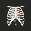 Cage of Ribs