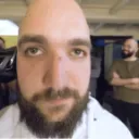 Calvos con pelo
