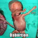 Dabortion👶🏼
