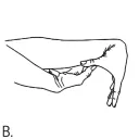 /r/Hypermobility