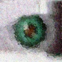 Visual Snow