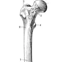 Limb Lengthening