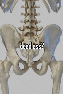 dead ass