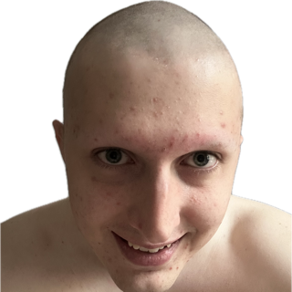 yolihy bald | .gg/renfra