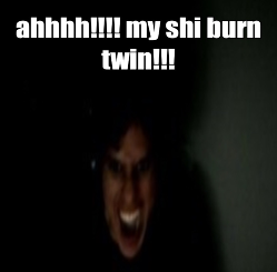 ahhh my shi burn twin