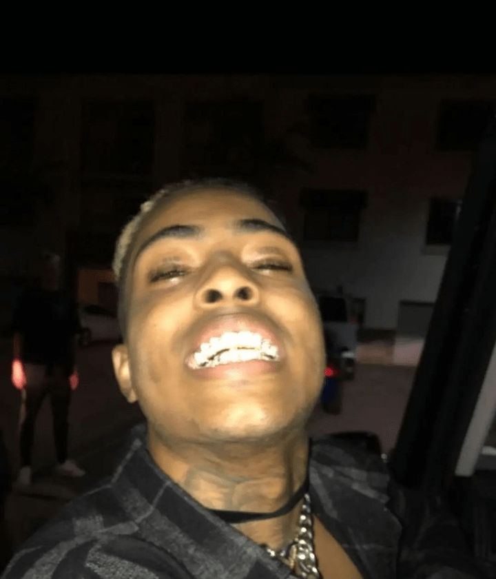 xxxtentacion grillz flex